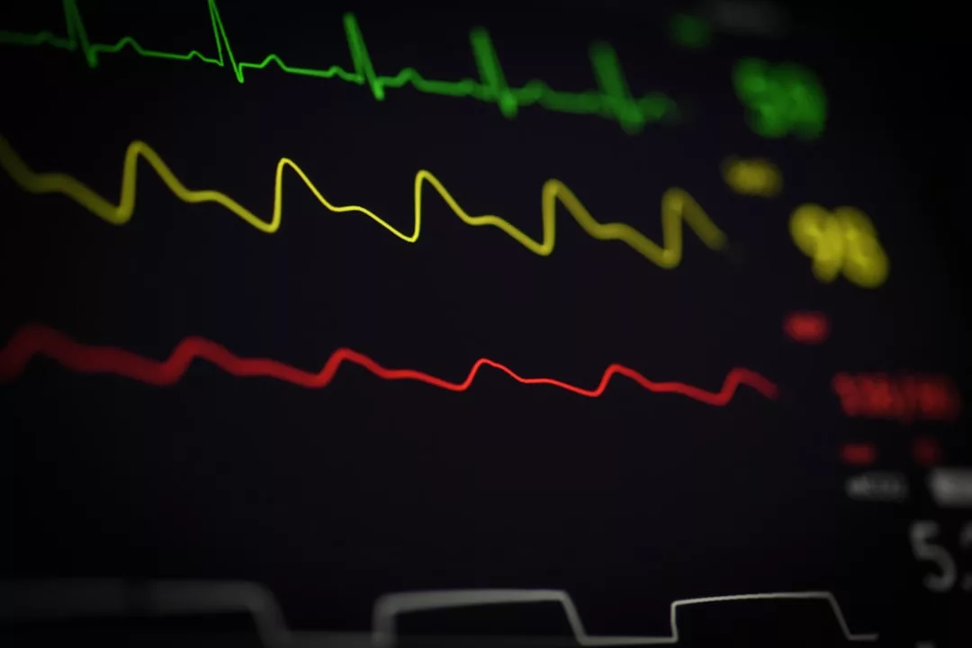 Eine Nahaufnahme eines medizinischen Monitors zeigt grüne, gelbe und rote Linien, die Vitalparameter wie Herzfrequenz und Sauerstoffsättigung darstellen - wichtig für die Herzgesundheit, besonders bei Senioren.